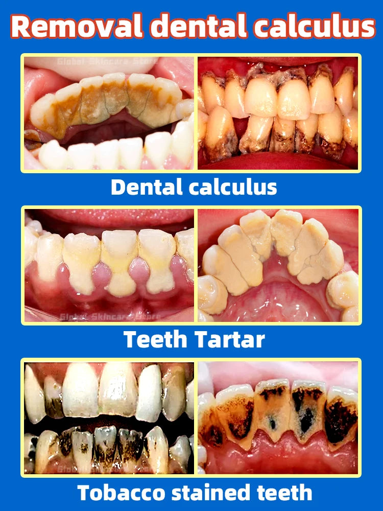 Toothpaste Whitening Tooth Remove Stains