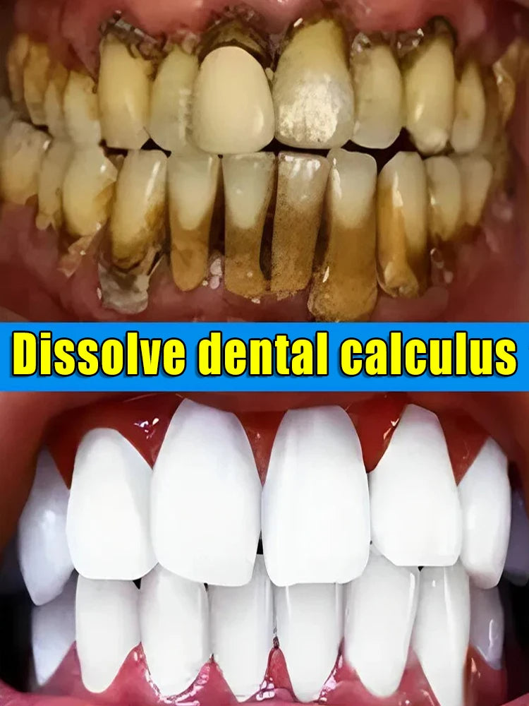 Toothpaste Whitening Tooth Remove  Stains